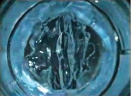 Polymer Gel