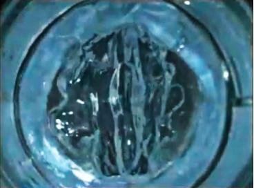 Polymer Gel