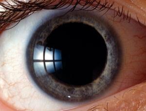 Pupil Dilation