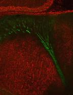 Rat Brain