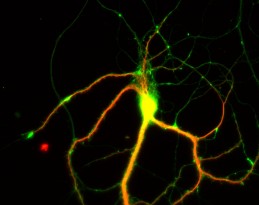 Rat hippocampal neurons (The Cell image library)