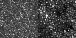Rod Images