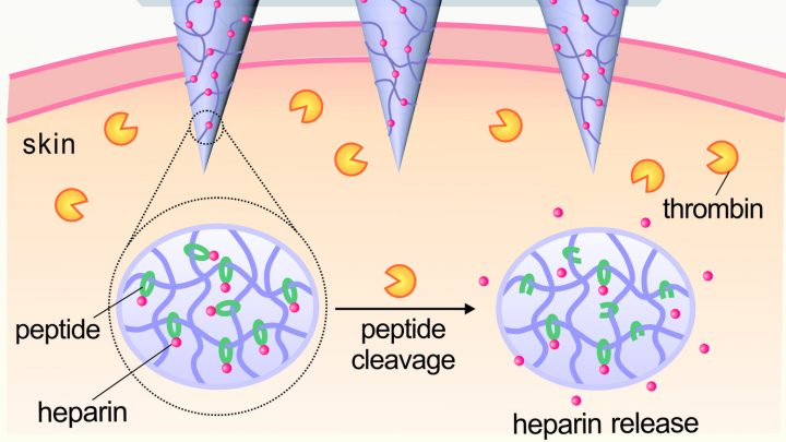 Smart Microneedle Patch for Thrombosis