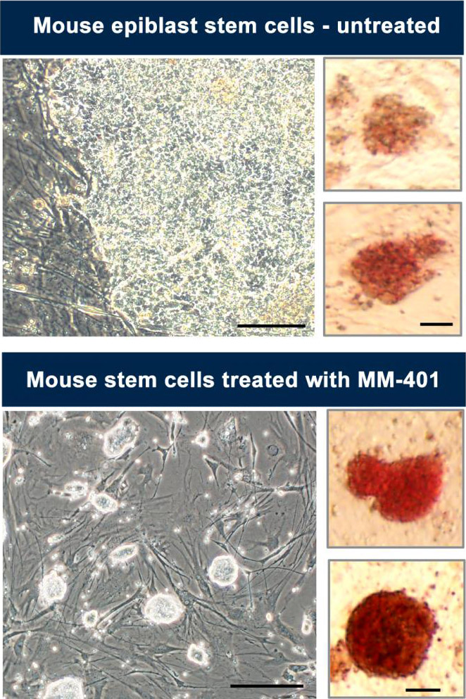 Stem-Cells-Before-and-After-Treatment