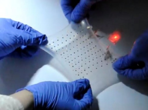 Stretchable battery