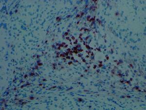 T Cells