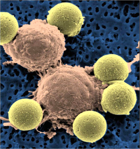 T-cells_dividing