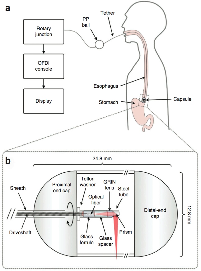 Tethered capsule endomicroscopy.