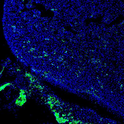 The Promise of Chimeric Organisms