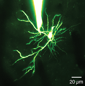 This is a dendrite