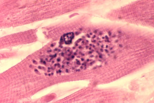 Toxoplasma_gondii