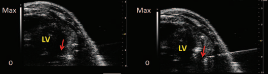 Ultrasound imaging of hMSCs
