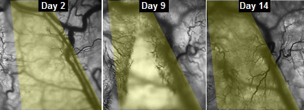 Veins-growing-into-muscle-fibers