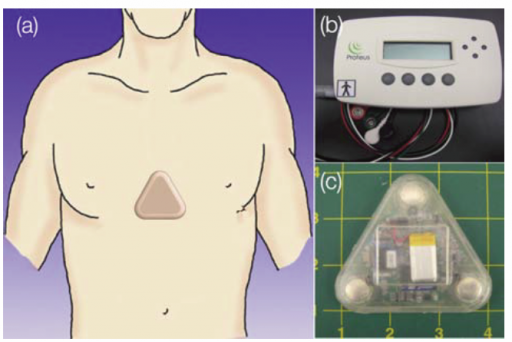 Wearable health monitor