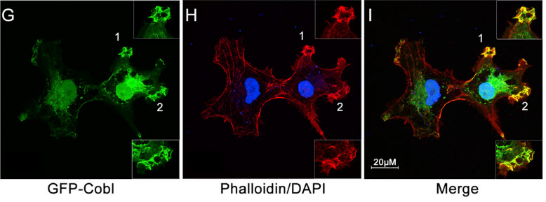 actin nucleation