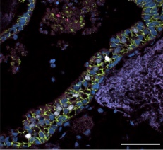 airway-like structures