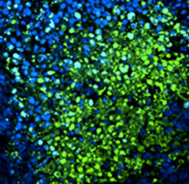 apoptosis