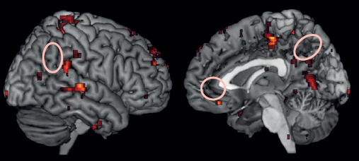 areas active - task-unrelated