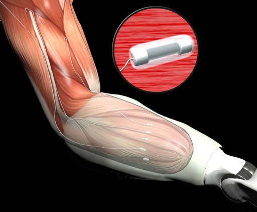 armMuscle1