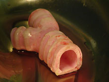 artificial_trachea