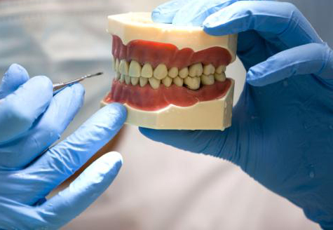 3D_printed_mandible