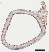 blood-vessel graft