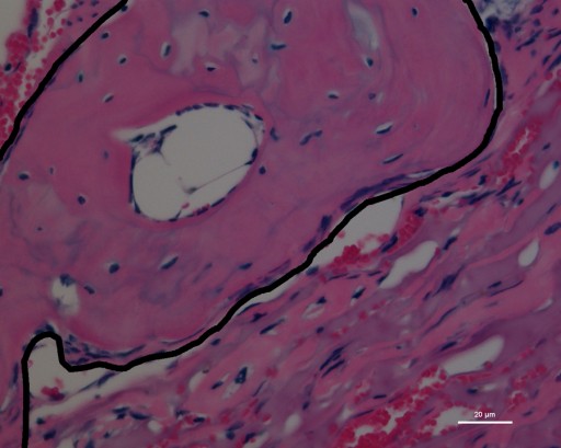 bone-repair-outlined