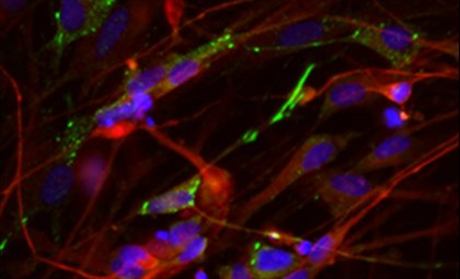 brain-cells-anacker