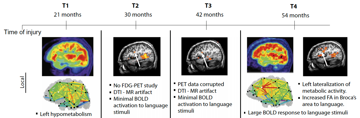 brain changes over time