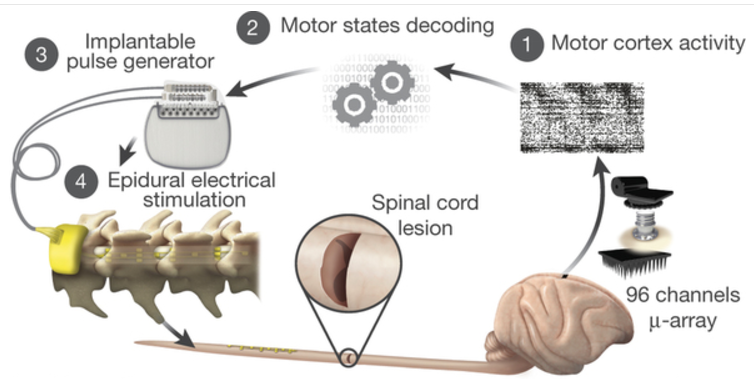 brain-spine interface system