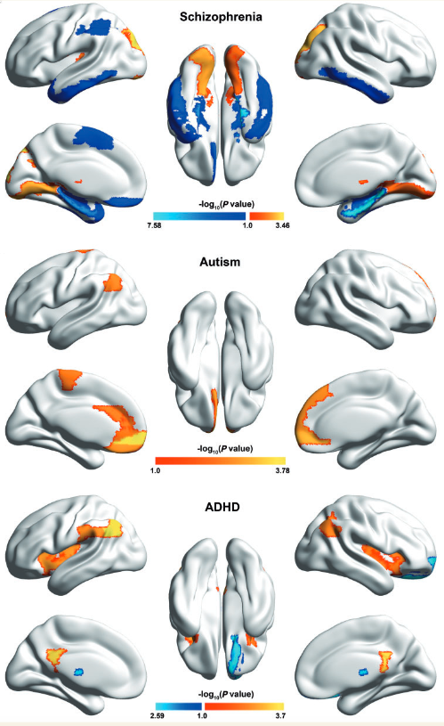 brain variability - mental disorders vs. healthy