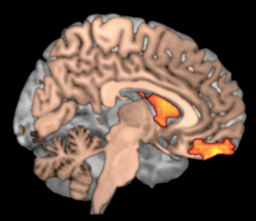 brain_dopamine