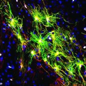 brain_mice_human_astrocytes brain_mice_human_astrocytes