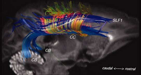 brainpathways1 brainpathways1