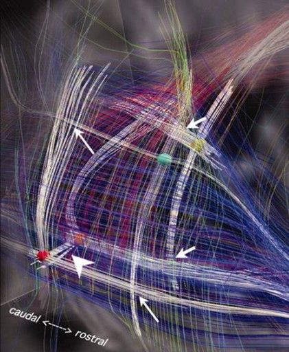 brainpathways2