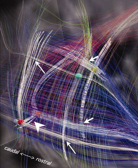 brainpathways2 brainpathways2