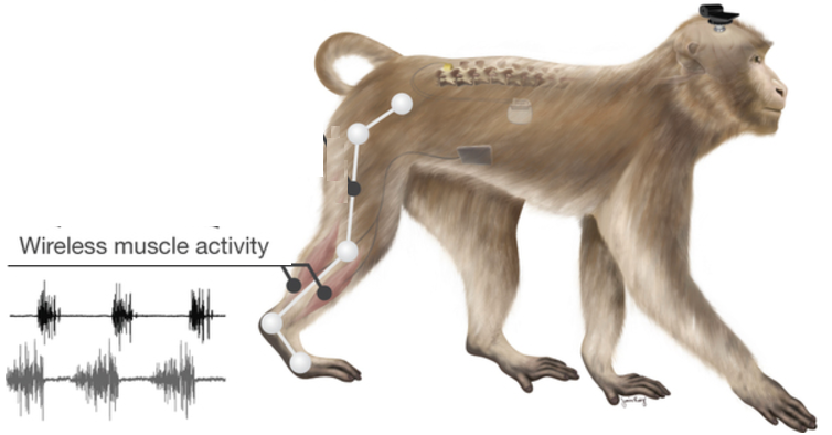 brain–spine interface restores walking