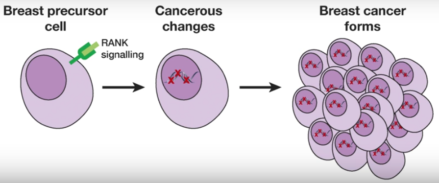 breast cancer formation