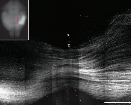 callosal axon pathways