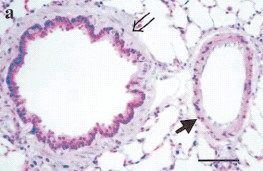 Normal lung cells (rat) Normal lung cells (rat)