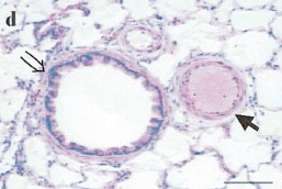 After cell-based gene therapy After cell-based gene therapy