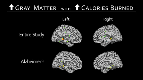 cerebral hemispheres Figure 3