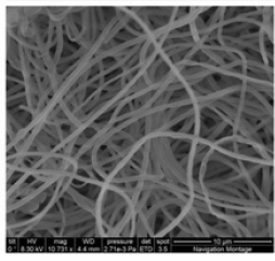 chondroitin sulfate fibers
