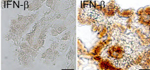 choroid plexus - young & aged