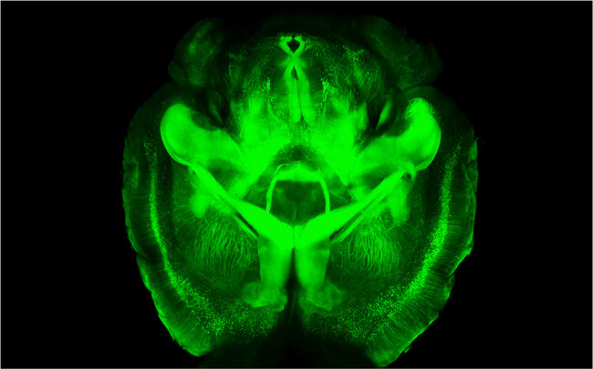 clarified_brain clarified_brain