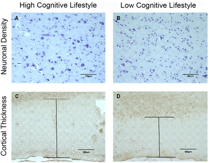 cognitive_lifestyles