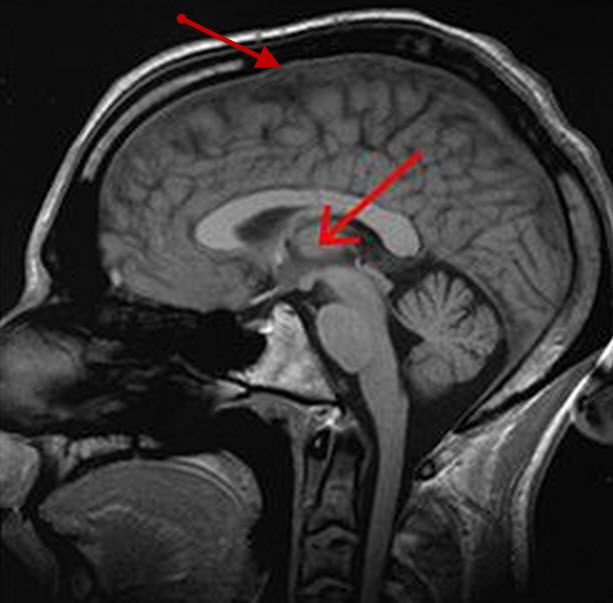 cortex&thalamus