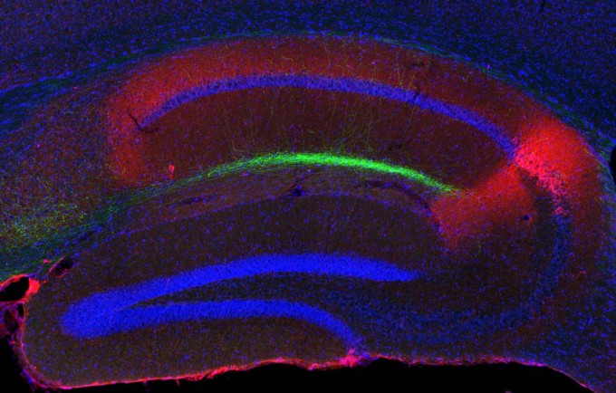 cross_section_hippocampus