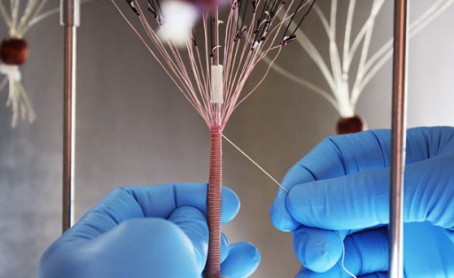 cytograft1
