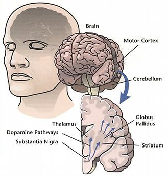 dopamine in Parkinson's